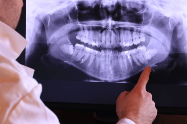 Best Emergency Gum Treatment in Edmore, MI
