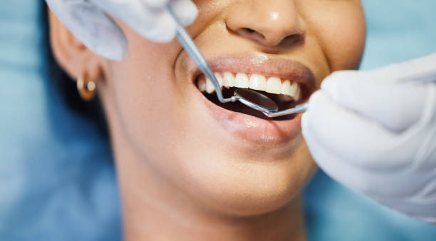 Best Emergency Gum Treatment in Edmore, MI
