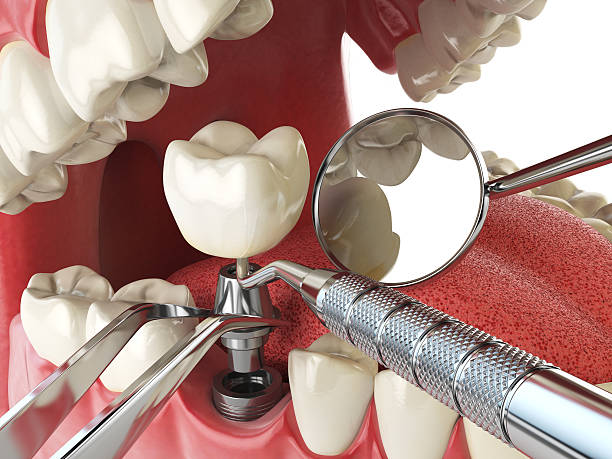 Best Urgent Care for Lost Fillings or Crowns in Edmore, MI