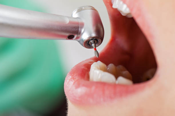 Best Emergency Treatment for Dental Infections or Abscesses in Edmore, MI